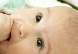 7-Effective-Tips-To-Treat-Sticky-Eyes-In-Infants-910x1024.jpg