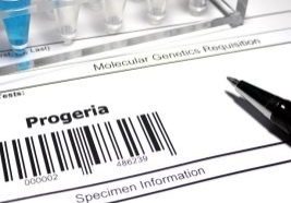 Neonatal-Progeroid-Syndrome-Causes-Symptoms-And-Treatment.jpg